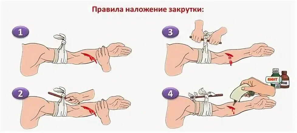 Как правильно остановить кровотечение: основы первой помощи