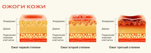 Важные шаги первой помощи при химических ожогах кислотами и щелочами